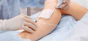 Ağrısız Varis Tedavisi Nasıl Yapılır?