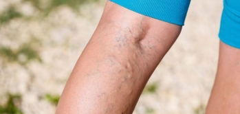 Varis Nasıl Anlaşılır ?